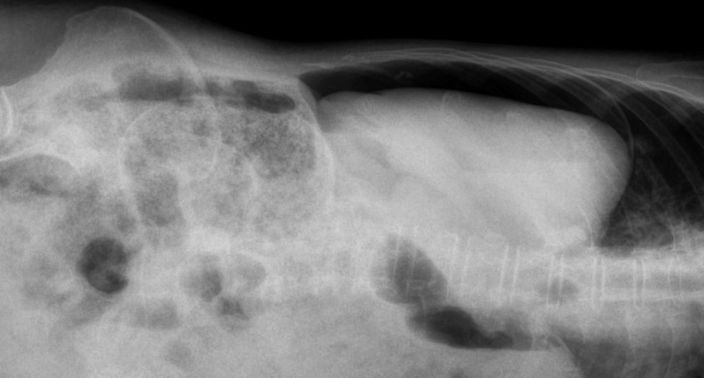 Hoe kan de aanwezigheid van pneumoperitoneum tijdens een onderzoek worden vastgesteld?