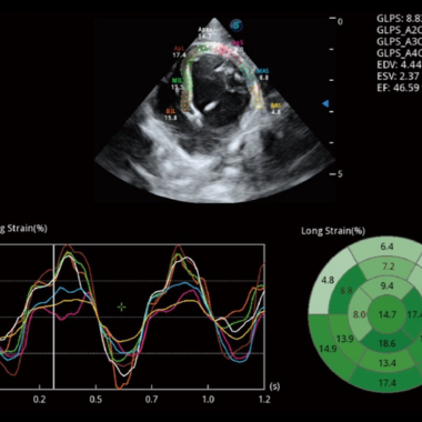 grid radiologie veterinaire vetx